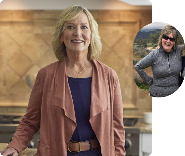 Before and After of Susan
