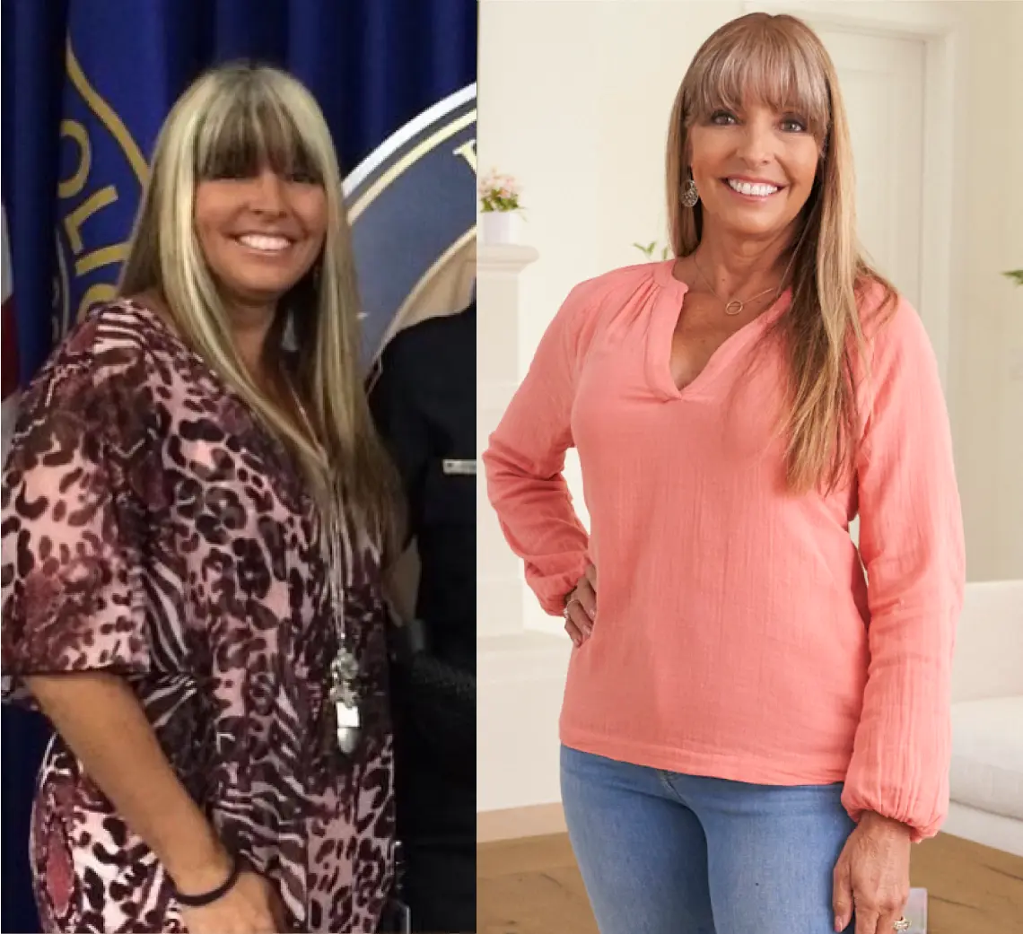 Before and after comparison of weight loss